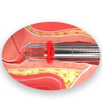 equipamentos medicos